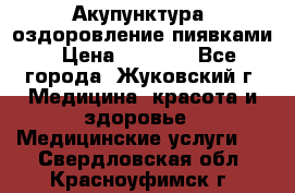 Акупунктура, оздоровление пиявками › Цена ­ 3 000 - Все города, Жуковский г. Медицина, красота и здоровье » Медицинские услуги   . Свердловская обл.,Красноуфимск г.